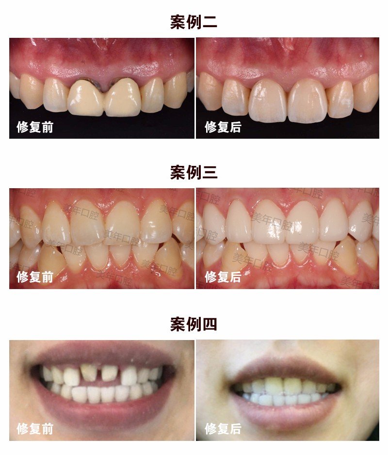 https://img.yiyiaimei.com/mnt/Editor/2017-07-17/596c621ba53af.jpg
