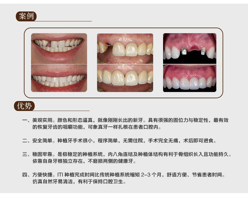 https://img.yiyiaimei.com/mnt/Editor/2017-07-17/596c65afcb06d.jpg