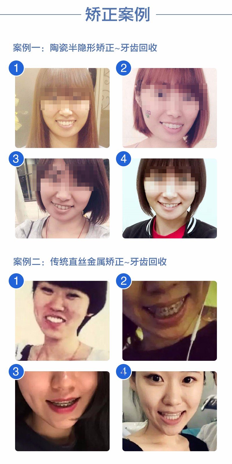 https://img.yiyiaimei.com/mnt/Editor/2017-07-17/596c6906e4137.jpg