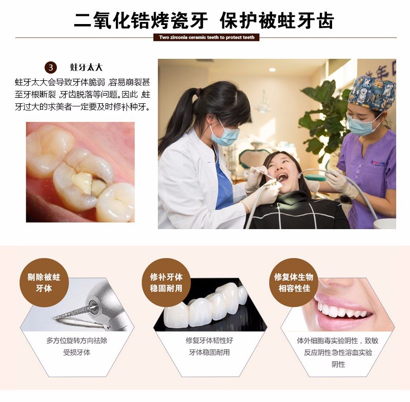 https://img.yiyiaimei.com/mnt/Editor/2017-07-17/596c6b9bef13e.jpg