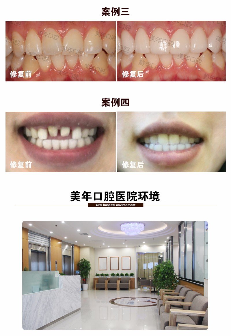 https://img.yiyiaimei.com/mnt/Editor/2017-07-17/596c6b9ccf22f.jpg