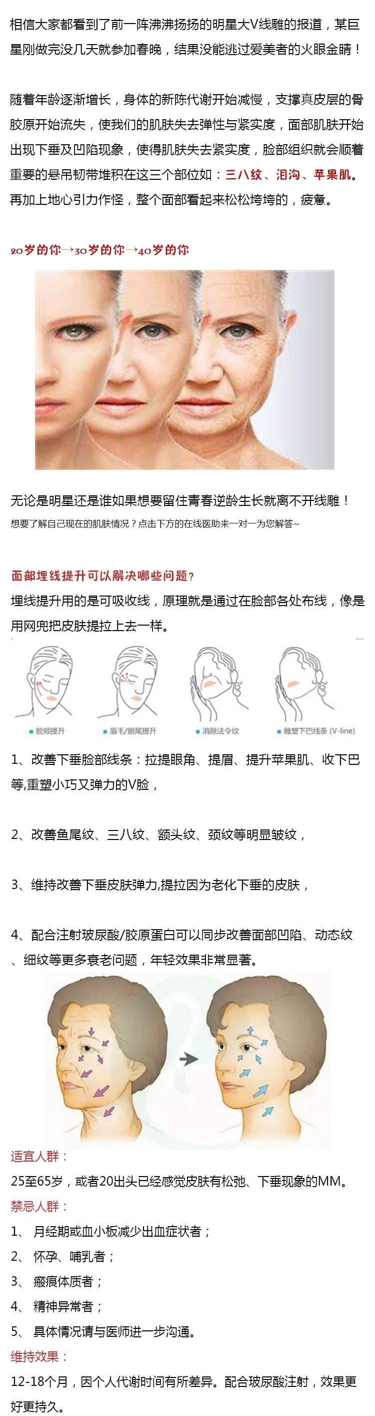 https://img.yiyiaimei.com/mnt/Editor/2017-07-20/597058e2bc344.jpg
