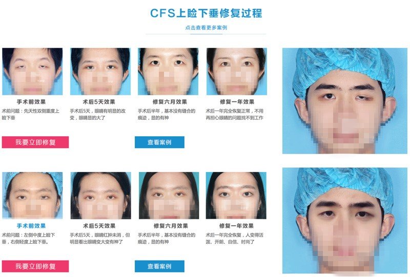案例图片