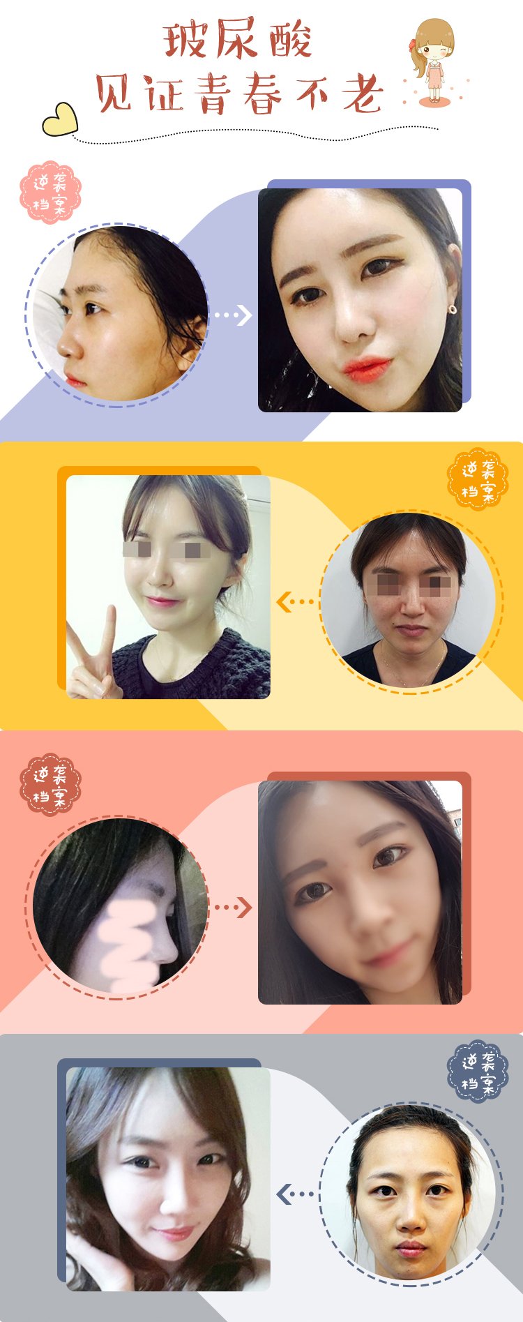 https://img.yiyiaimei.com/mnt/Editor/2017-07-24/597573a303b86.jpg