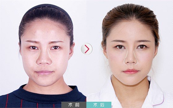 https://img.yiyiaimei.com/mnt/Editor/2017-08-23/599d321a051ae.jpg