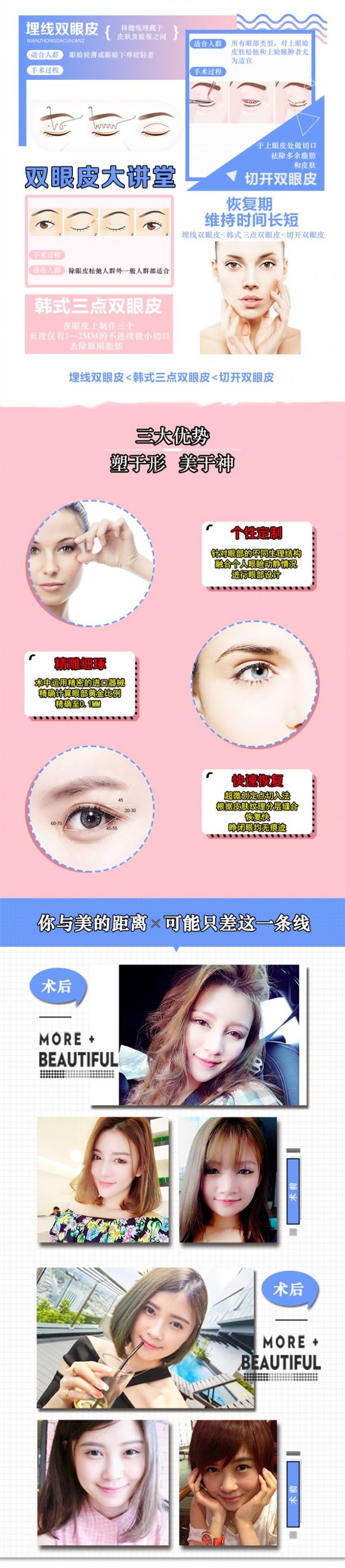 https://img.yiyiaimei.com/mnt/Editor/2017-08-28/59a39c262ae3f.jpg