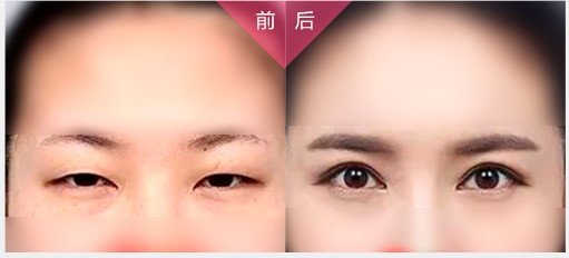 https://img.yiyiaimei.com/mnt/Editor/2017-08-28/59a3c0eaa469b.jpg