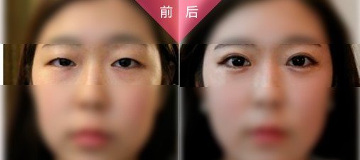 https://img.yiyiaimei.com/mnt/Editor/2017-08-28/59a3c0eb28668.jpg