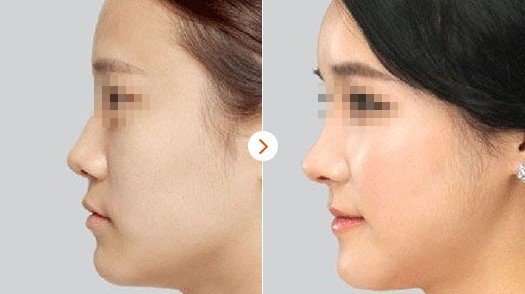 https://img.yiyiaimei.com/mnt/Editor/2017-08-28/59a3c2665aad3.jpg