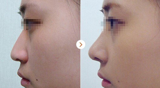 https://img.yiyiaimei.com/mnt/Editor/2017-08-28/59a3c2677e13d.jpg