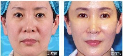https://img.yiyiaimei.com/mnt/Editor/2017-08-28/59a3c48d078b8.jpg