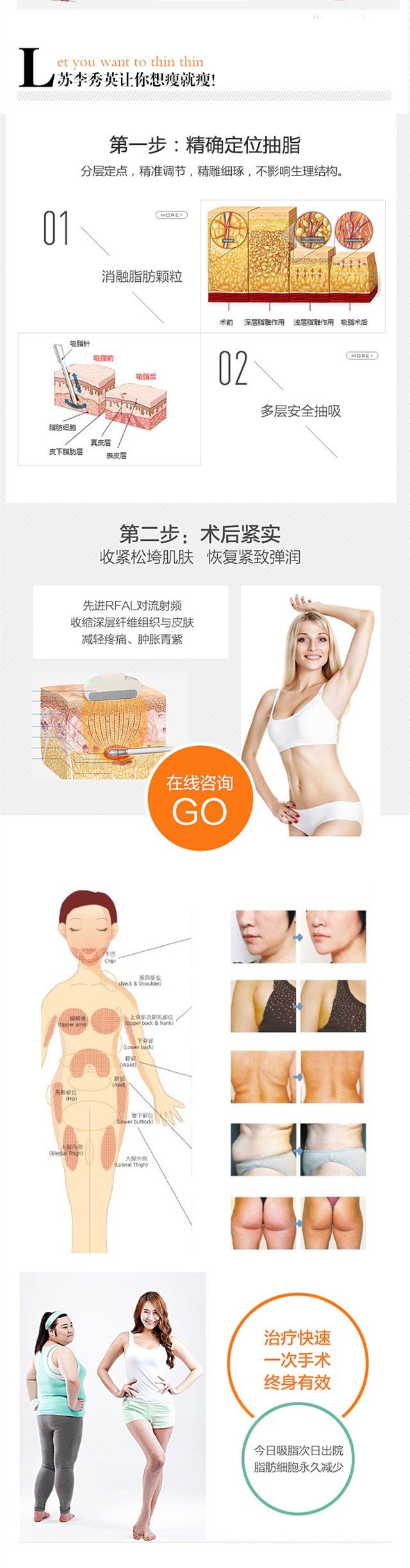 https://img.yiyiaimei.com/mnt/Editor/2017-09-06/59af736c57ddc.jpg