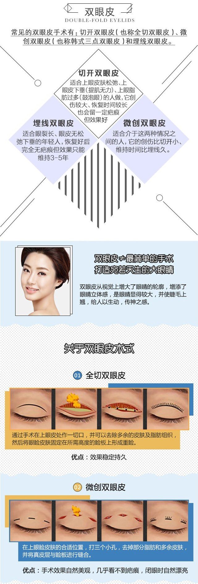 https://img.yiyiaimei.com/mnt/Editor/2017-09-06/59af74a0f00b9.jpg
