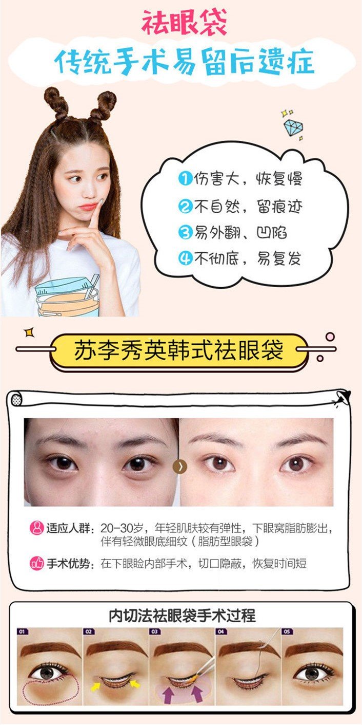 https://img.yiyiaimei.com/mnt/Editor/2017-09-06/59af7670dfdb1.jpg