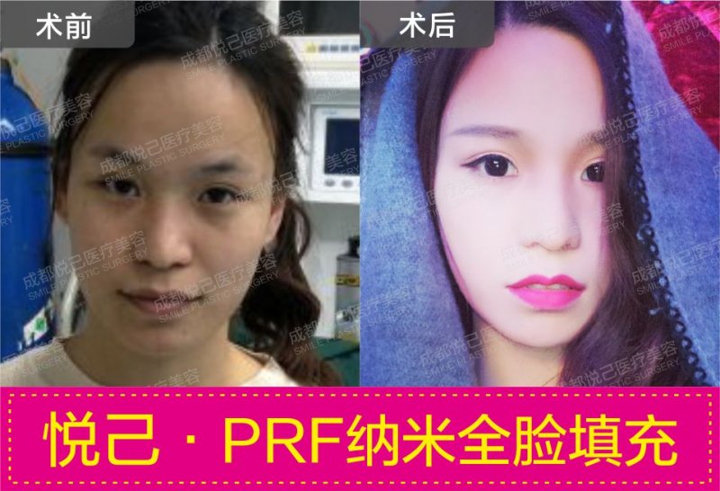 案例图片