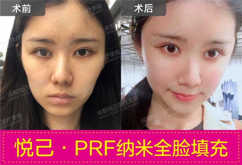 案例图片