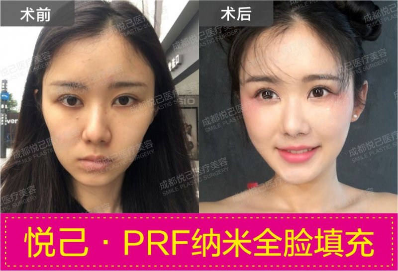 案例图片
