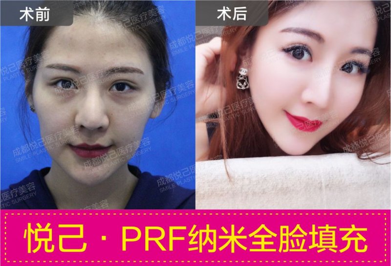 案例图片