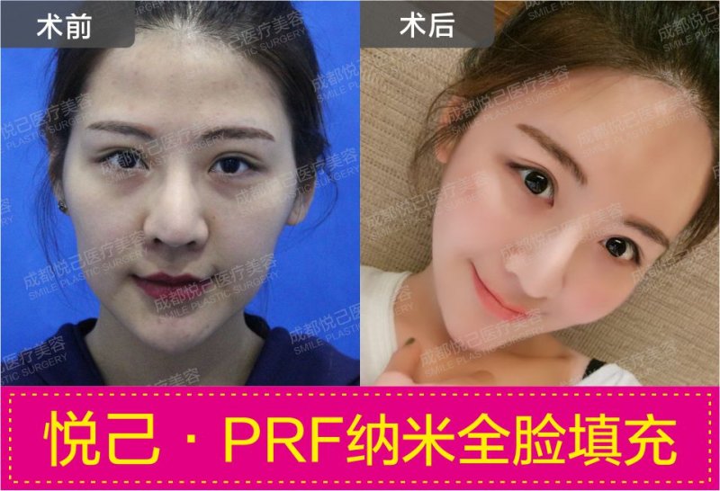 案例图片