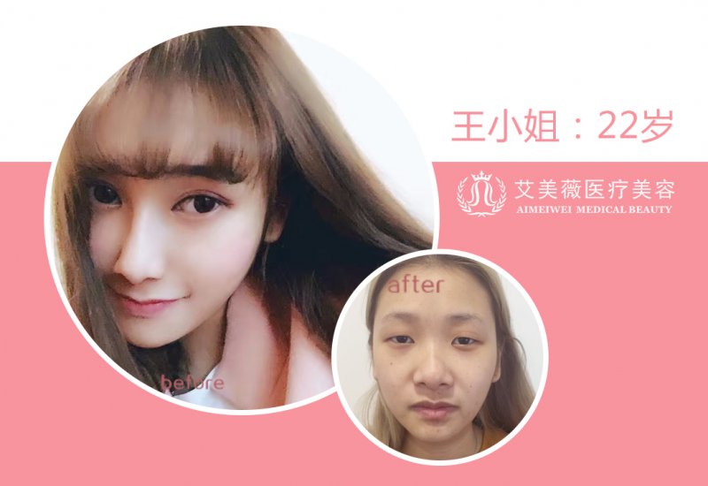 案例图片