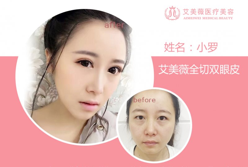 案例图片