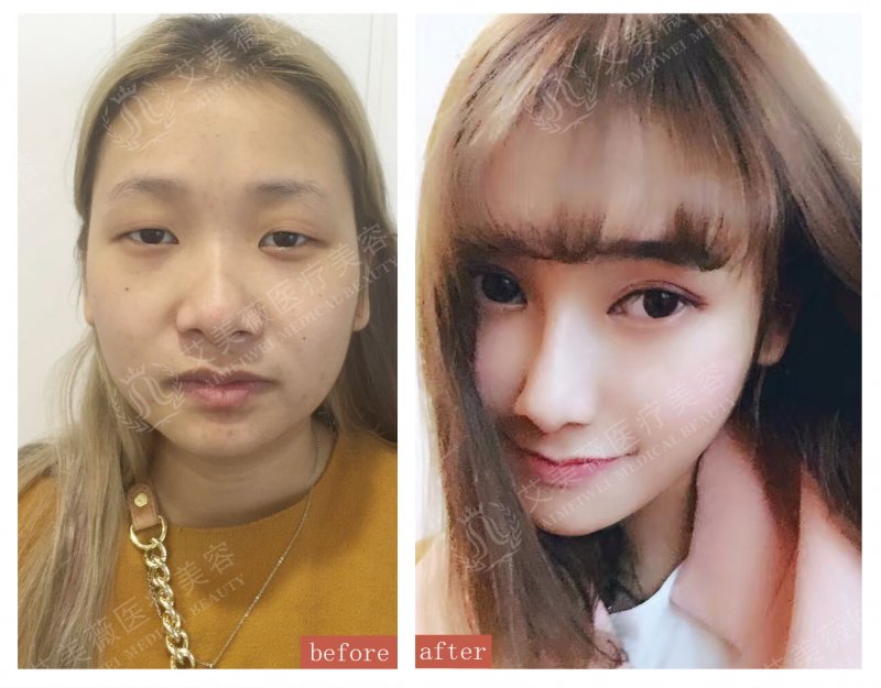 案例图片