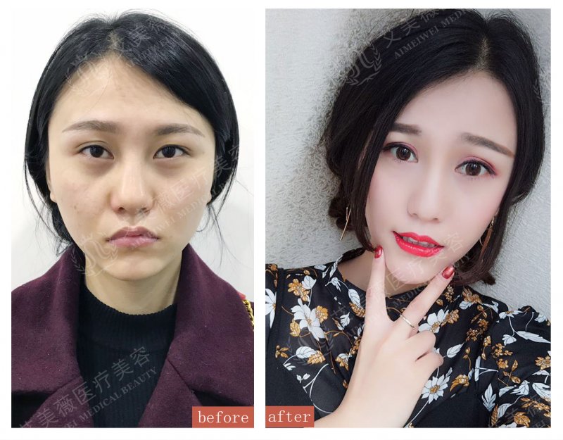 案例图片