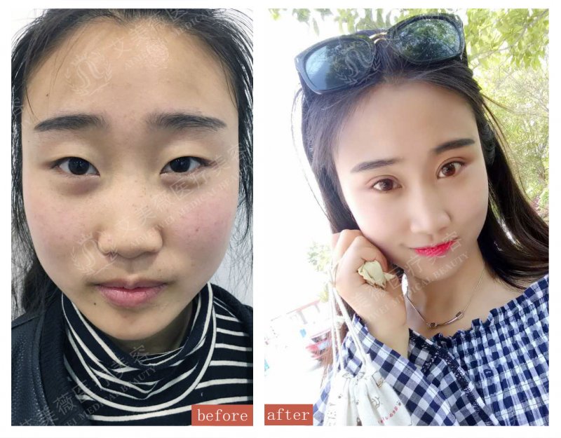 案例图片