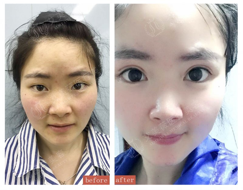 案例图片