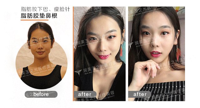 案例图片