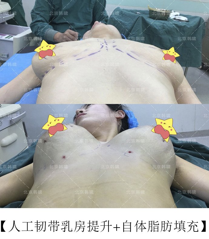 案例图片