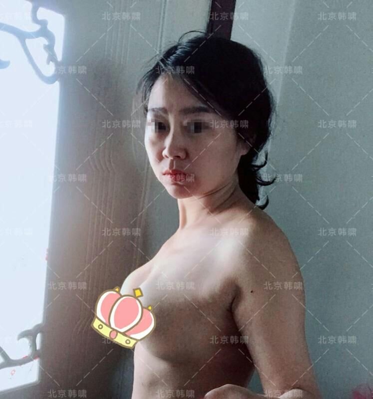 案例图片