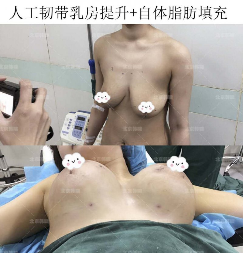 案例图片