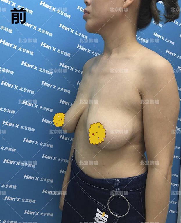 案例图片