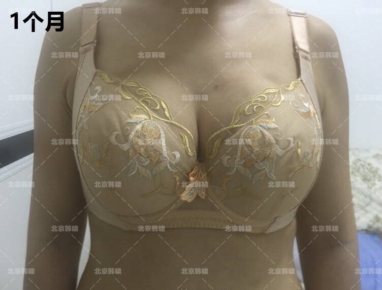 案例图片