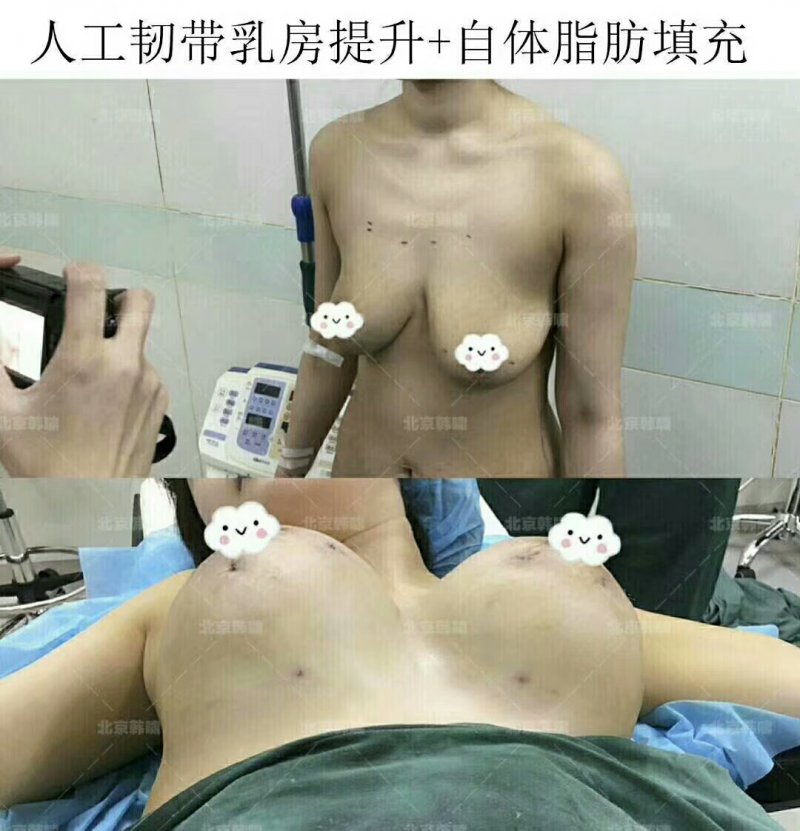 案例图片