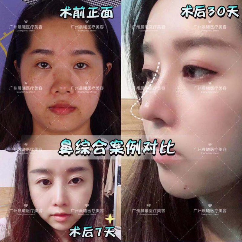 https://img.yiyiaimei.com/mnt/Editor/2019-03-26/5c9a075457009.jpg