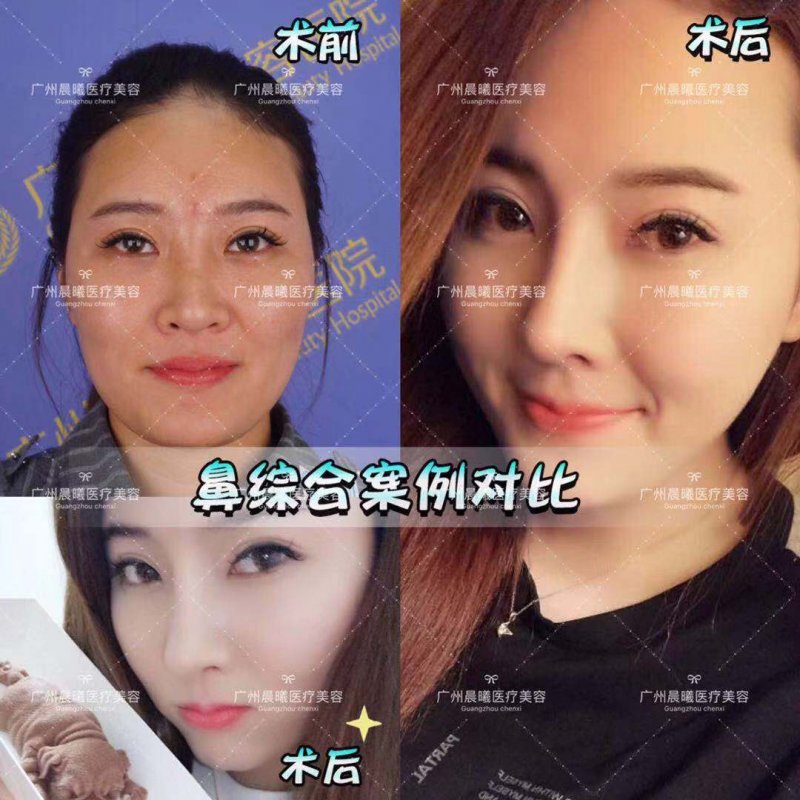 https://img.yiyiaimei.com/mnt/Editor/2019-03-26/5c9a0754a35a9.jpg
