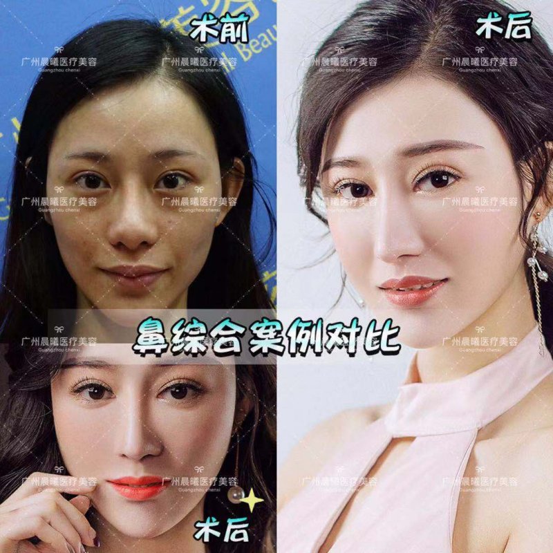 https://img.yiyiaimei.com/mnt/Editor/2019-03-26/5c9a07550afec.jpg