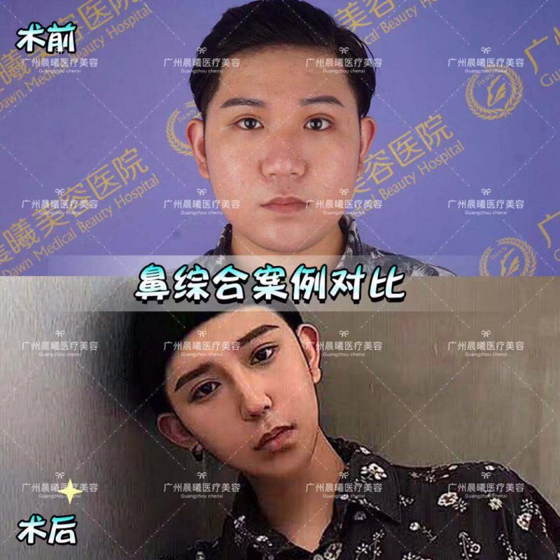 https://img.yiyiaimei.com/mnt/Editor/2019-03-26/5c9a075556aa5.jpg