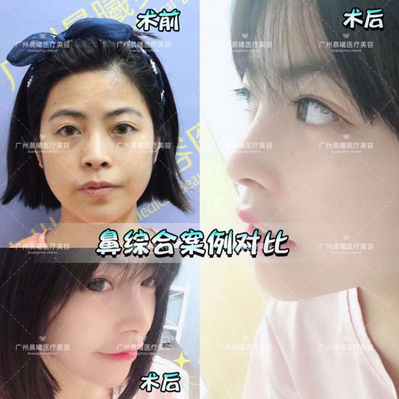 https://img.yiyiaimei.com/mnt/Editor/2019-03-26/5c9a0755aa1ff.jpg