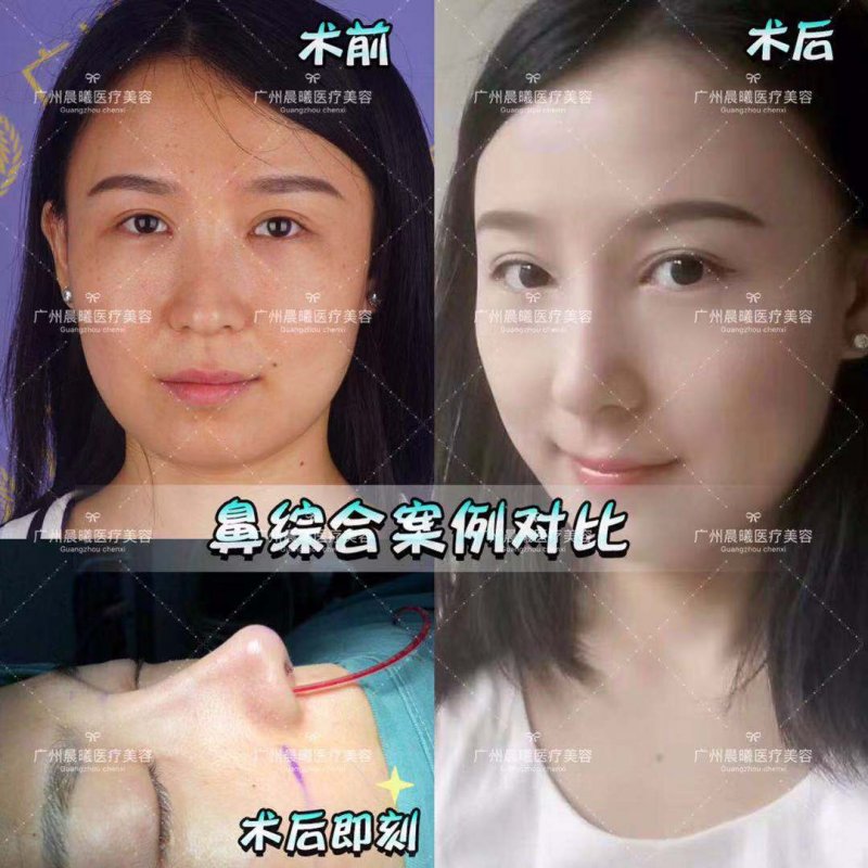 https://img.yiyiaimei.com/mnt/Editor/2019-03-26/5c9a07560d63a.jpg