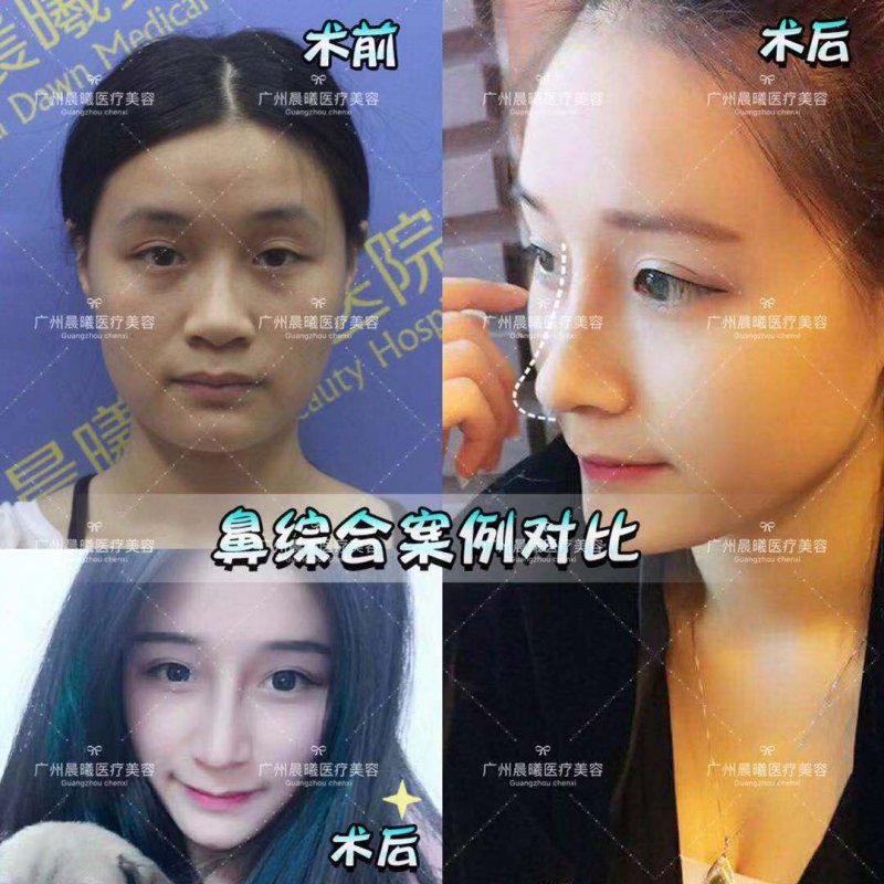 https://img.yiyiaimei.com/mnt/Editor/2019-03-26/5c9a0756630c4.jpg