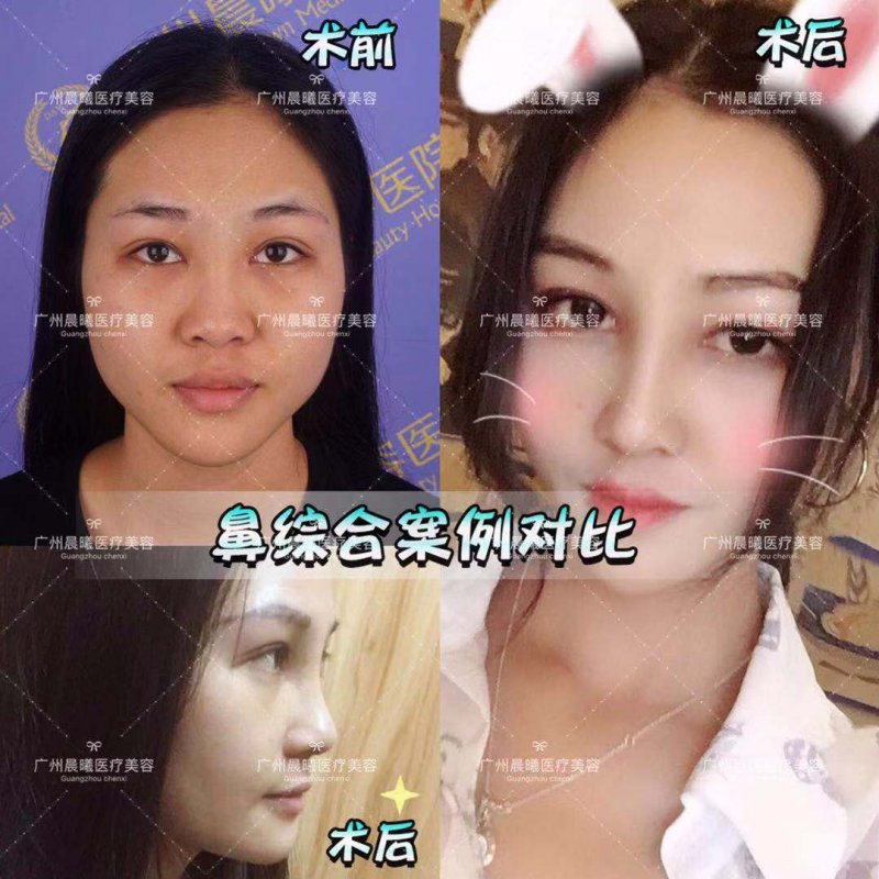 https://img.yiyiaimei.com/mnt/Editor/2019-03-26/5c9a07573c08b.jpg