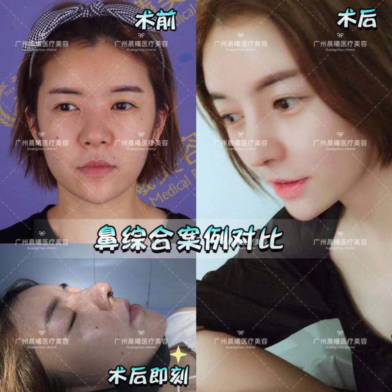 https://img.yiyiaimei.com/mnt/Editor/2019-03-26/5c9a0757f05b0.jpg