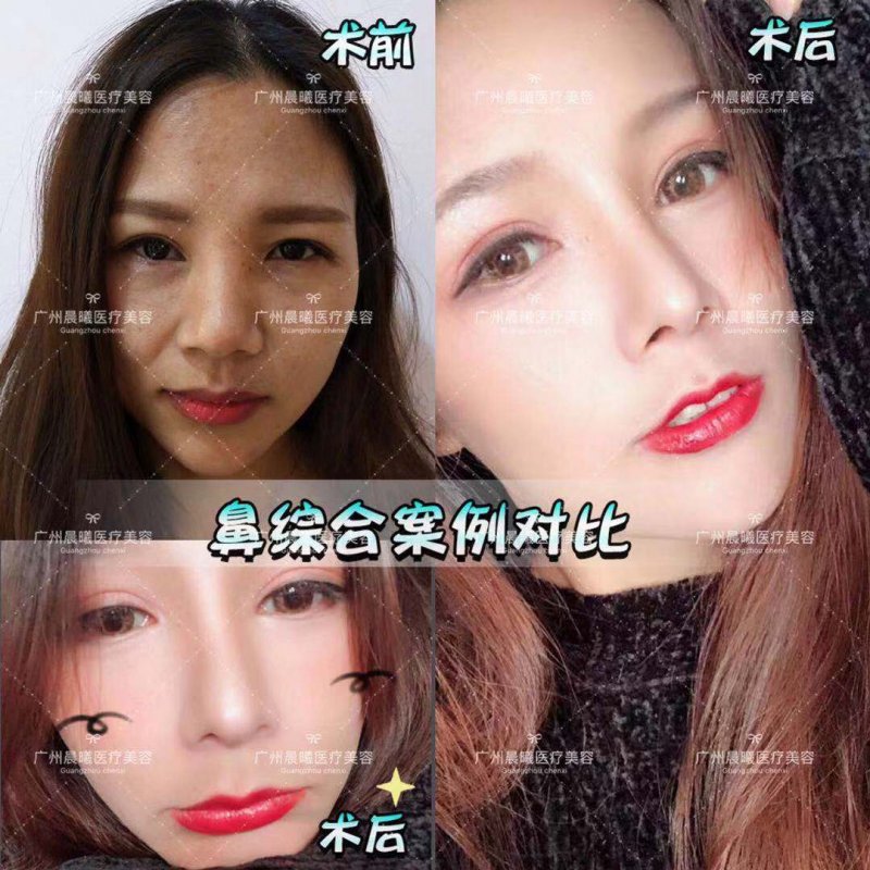https://img.yiyiaimei.com/mnt/Editor/2019-03-26/5c9a0758458d6.jpg