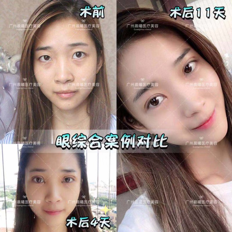 案例图片