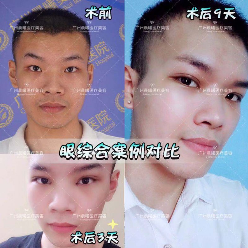 案例图片