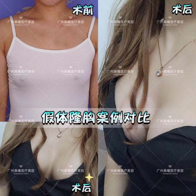 案例图片