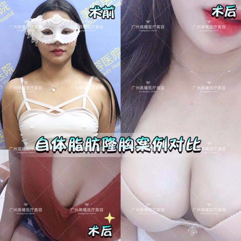 案例图片